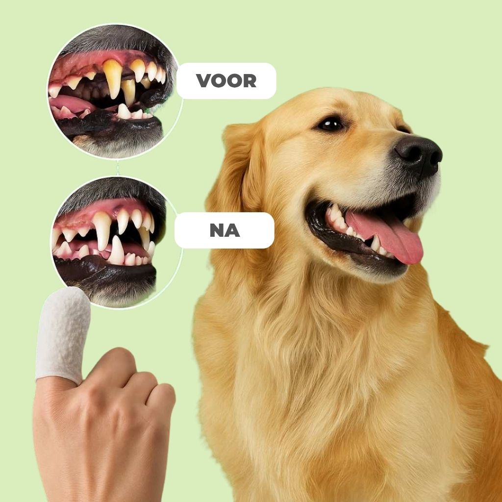 FreshWipe Kit – Beschermt tegen tandproblemen