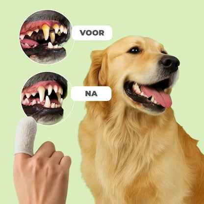 FreshWipe Kit – Beschermt tegen tandproblemen